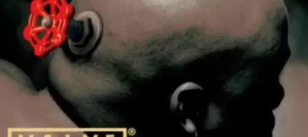 Valve