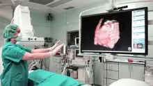 Kinect